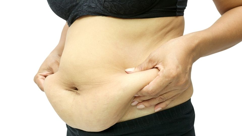 Can You Prevent Saggy Skin After Weight Loss Surgery?