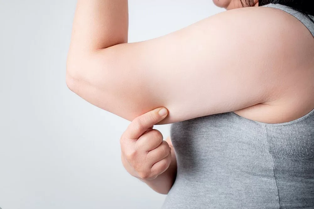 Woman Pinching Arm Fat