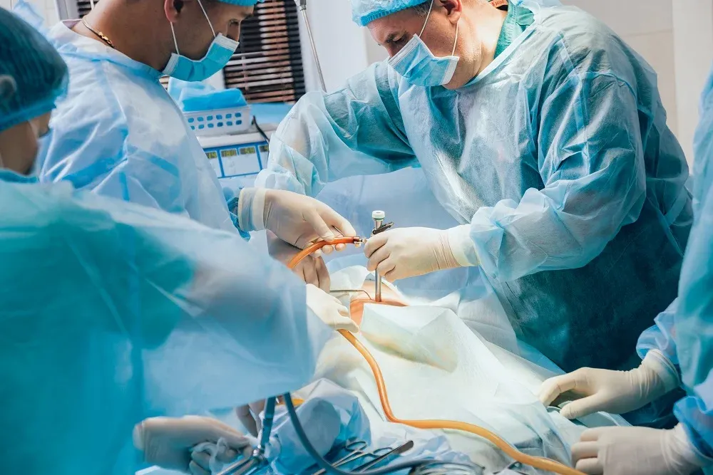 Doctors Performing Laparoscopic Incisional Hernia Repair