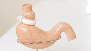 Can You Get A Lap Band After a Gastric Bypass?