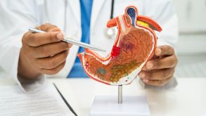 Is a Stretched Stomach After Gastric Sleeve Possible?