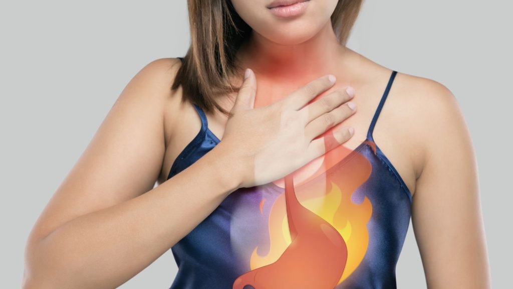 How to Treat GERD After Gastric Sleeve Surgery