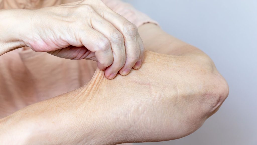 Managing Loose Skin After Major Weight Loss