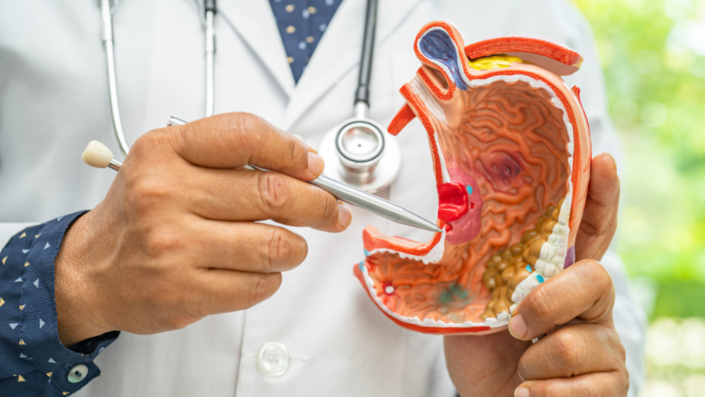 top 6 foods to avoid after gastric bypass