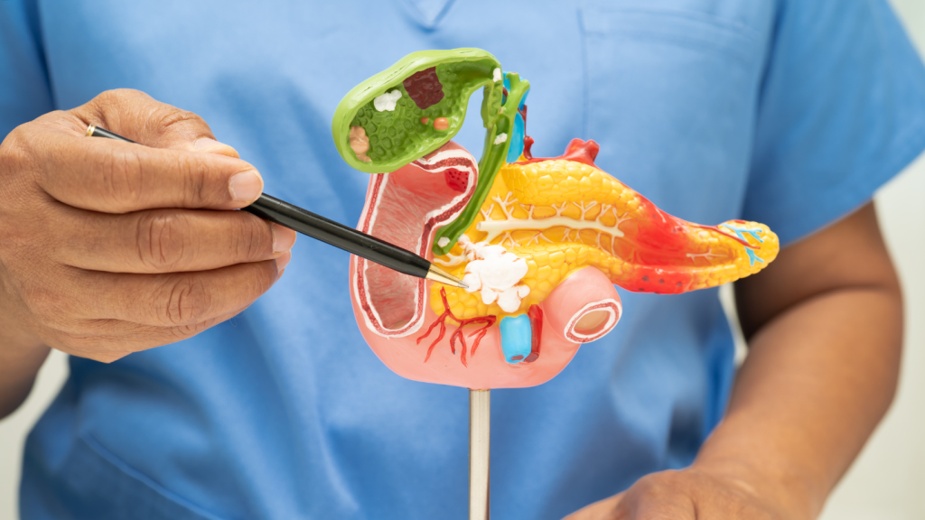 foods to avoid after gallbladder surgery