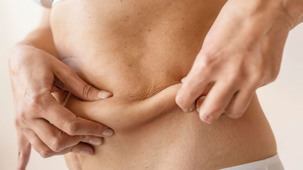Common Areas Where Loose Skin May Develop