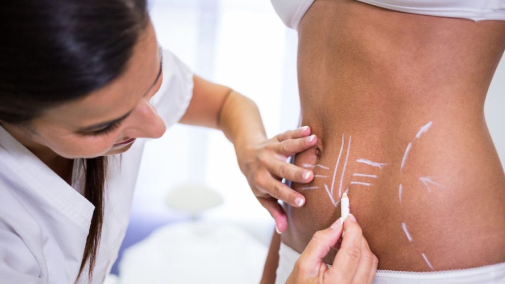 Treatment Options for Excess Skin After Weight Loss